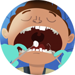 How Cavities Are Made